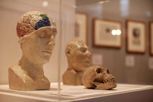 A skull displayed at the Wellcome trusts ‘Brains’ exhibition at the Wellcome Collection on March 27, 2012 in London, England. 