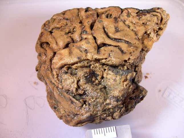 A sample of the Heslington brain.