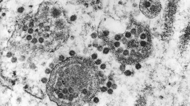 The Eastern equine encephalitis (EEE) virus, seen above infecting cells in the central nervous system.