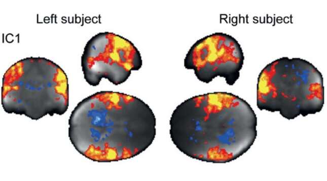 Esto es lo que les ocurre a los cerebros de dos personas cuando se acarician
