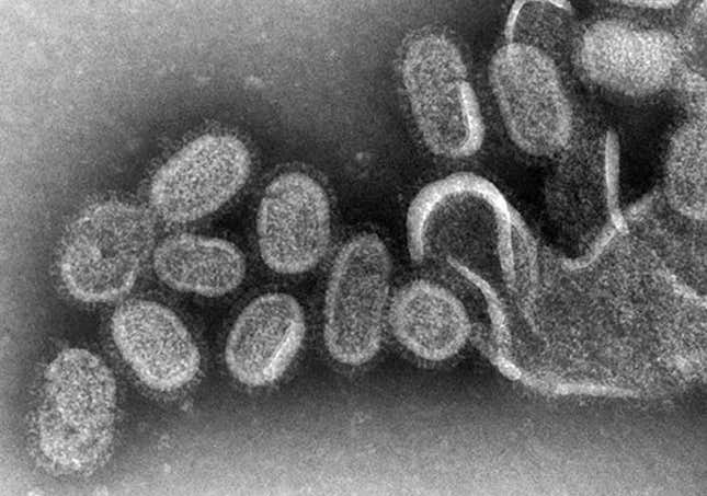 Micrografía de electrones que muestra virus Influenza causantes de la gripe.