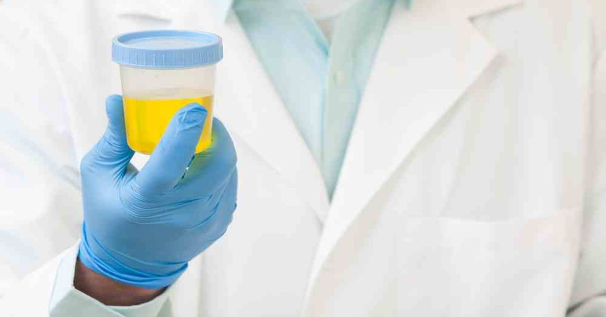 Why Do Vitamins Make Urine Bright Yellow? Gizmodo Australia