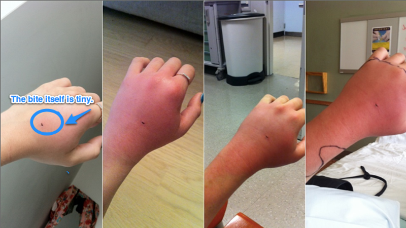 Why Cat Bites Are Pretty Much The Worst Thing Ever