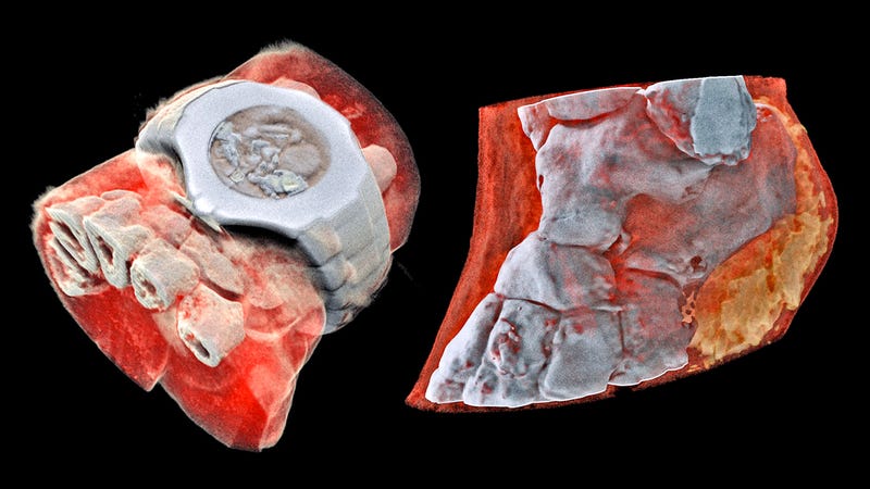 The World S First Full Color 3d X Rays Are Freaking Me Out