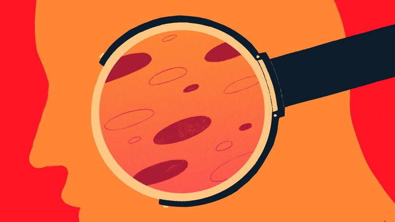 What Is Fungal Acne And Why Do So Many People Suddenly Think They