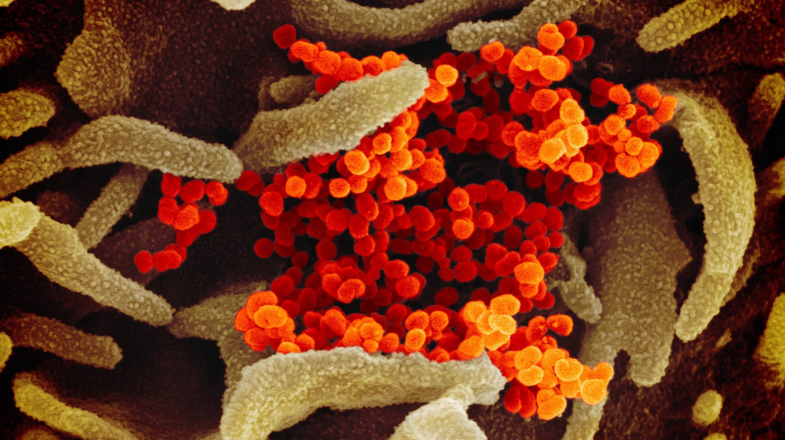 Coronavirus SARS-Cov-2 emergiendo de una célula infectada.