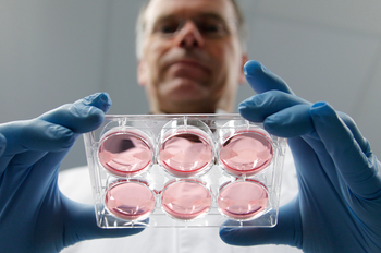 Professor Mark Post holds a tray of in-vitro meat samples that will become lab-grown burgers