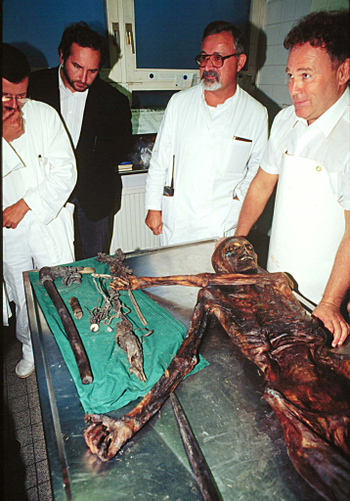 The 5,000-year-old body of a hunter discovered in 1991 by German hikers on the Similaun glacier at a 3,000 meters altitude (10,000 feet), on the Italian side of the Alps, and taken to the Austrian town of Innsbruck, where it&#039;s actually preserved. Seven years after it&#039;s recover authorities have decided that the Bronze Age mummy will be brought back to the Italian town of Bolzano Friday, January 16 1998, where a special museum has been built for it. (AP Photo) Innsbruck,Austria, Sep 24--Frozen Body--Scientists of the Institute of Early History at the University of Innsbruck, started to study the frozen well-preserved body, that was found by tourists in the Austrian Alps. First estimates said, the corpse is between 3.500 and 4.000 years. (PE/str/s.n.s.) 1991