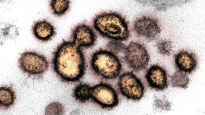 A scanning electron image of the coronavirus