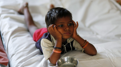 A malnourished child waits for food at the Nutritional Rehabilitation Centre in Sheopur district in the central Indian state of Madhya Pradesh