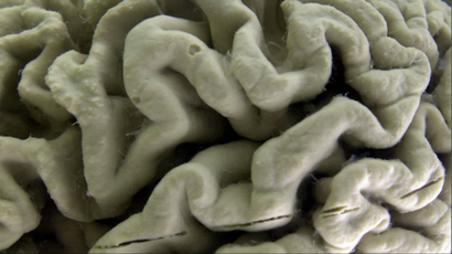A close-up image of a human brain.