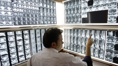 A radiologist examines X-rays