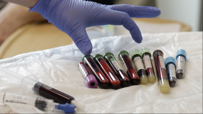 Vials of blood being used for cancer treatment.