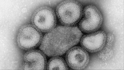 A microscopic image of a flu