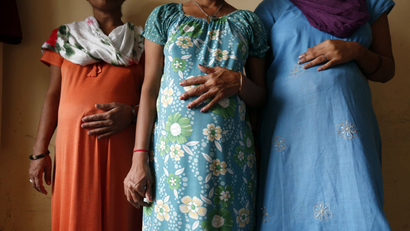 India-cesarean-c-section