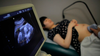 Wu Tianyang, who is five month pregnant with her second child, attends a sonogram at a local hospital in Shanghai September 12, 2014. REUTERS/Carlos Barria (CHINA - Tags: SOCIETY POLITICS) - RTR494SD