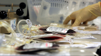 Cord blood in bags getting prepared to be frozen.