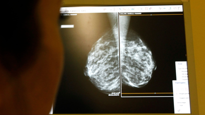 A doctor looking at a mammogram