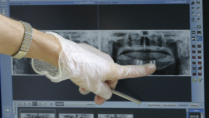 A person wearing a glove points at an X-ray of someones teeth.