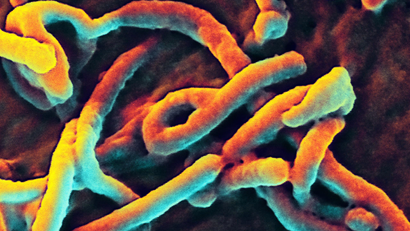 A scanning electron microscope image of the Ebola virus.