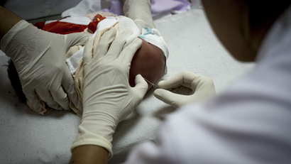 A baby born with congenital neurosyphilis undergoes cerebrospinal fluid collection.