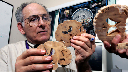 Researcher holding sections of a brain