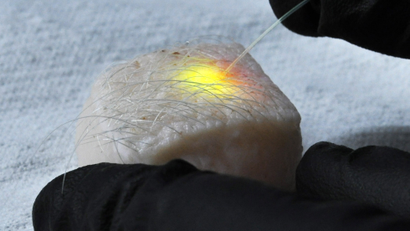 Intracellular microlasers at work in pig skin