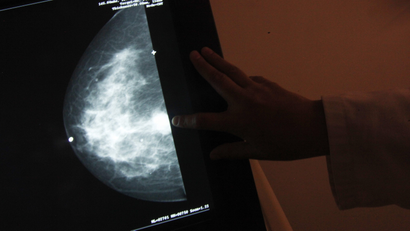 A monitor shows the image of a breast cancer at a centre run by the "Reto" Group for Full Recovery of Breast Cancer in Mexico City October 18, 2012. Breast cancer has been the leading cause of death in Mexican women since 2006, according to the group. The World Day Against Breast Cancer is commemorated on October 19. REUTERS/Edgard Garrido (MEXICO - Tags: HEALTH ANNIVERSARY) - RTR39B4C