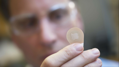 An image of the tiny microneedle patch being held by a researcher.