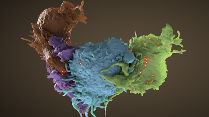 A scanning electron microscopic image of cells with HIV.