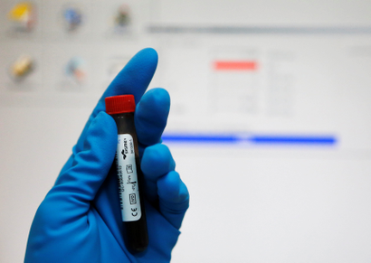A technician holds a test tube with a blood sample at the Russian anti-doping laboratory in Moscow, Russia, May 24, 2016.