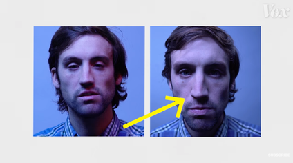 A person is shown in two different pictures, one in a selfie and one in a straight shot. In the selfie, their nose appears much larger.