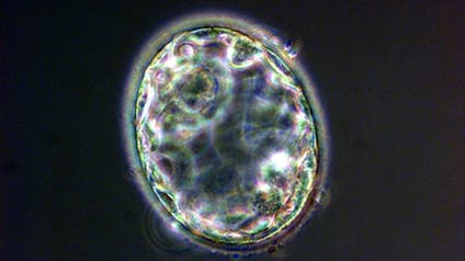 A handout photograph published May 19, 2005, shows a blastocyst, created at the Centre for Life in Newcastle upon Tyne, England, five days after the nuclear transfer took place.