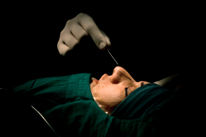 A person has a line drawn on their nose and is prepping for surgery. 