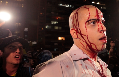 Bloodied protester in Brazil