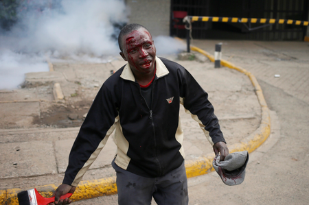 A protester bleeds after clashes with police in Nairobi.
