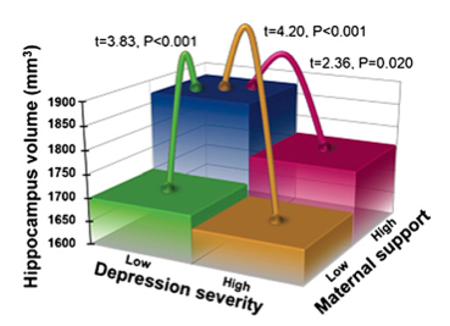 Graph showing relationship between depression, maternal support, and hippocampus volume