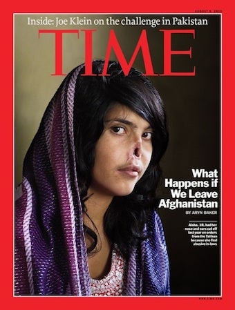 Illustration for article titled A Visual Introduction To An Afghan Woman's Mutilation