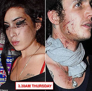 Illustration for article titled Amy Winehouse Is A Bloody Mess. Literally.