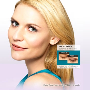 Illustration for article titled Eyelash Enhancer Could Help With Baldness