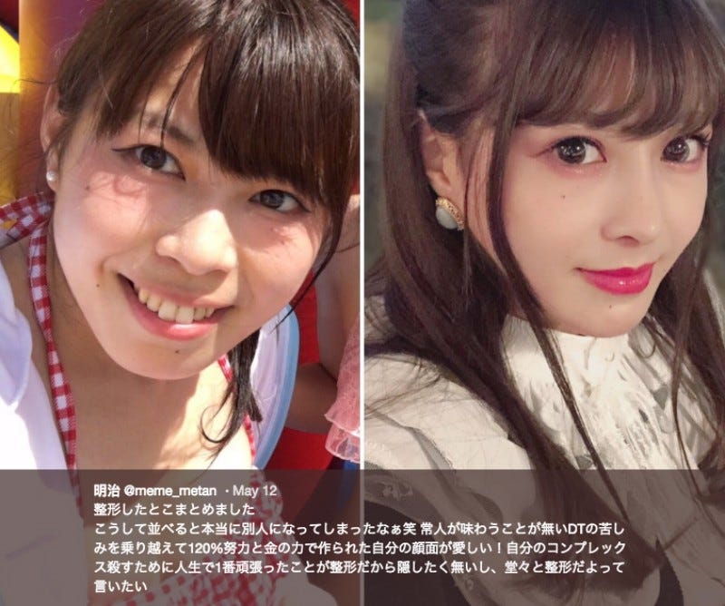 free japanese plastic surgery