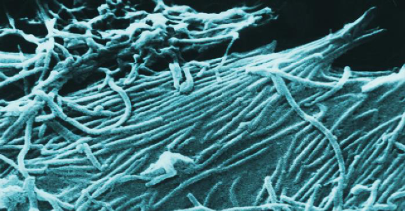 Illustration for article titled This is How Ebola Resists Treatment with Antibody Cocktails