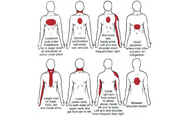 know the warning signs of a heart attack (they\u0027re different for women) Muscle Diagram Human Heart when most people think of heart attacks, they picture sudden and traumatic chest pain but heart attack symptoms can be mild and have different symptoms