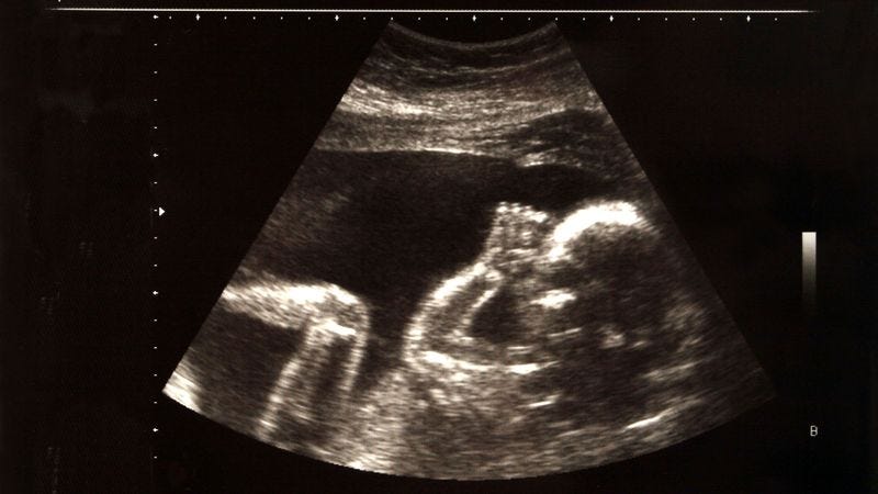 Illustration for article titled Fewer NBA Players Choosing To Learn Unborn Child’s Position