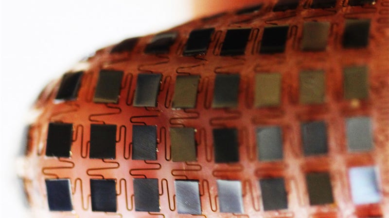 Illustration for article titled This Stretchable Battery Pack Wraps Around Anything and Charges Itself