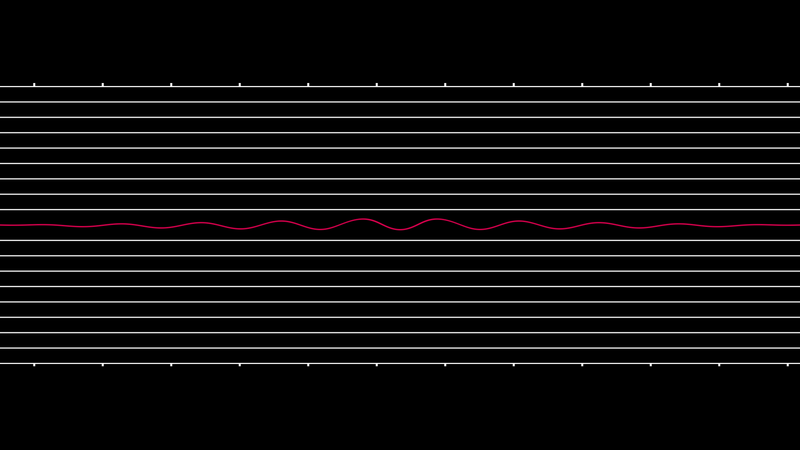 Illustration for article titled Anti-Abortion Extremists Are Controlling the Narrative on 'Heartbeat Bills'
