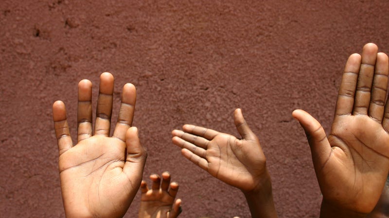 Illustration for article titled See What Children's Rashes Look Like on Darker Skin With 'Brown Skin Matters'