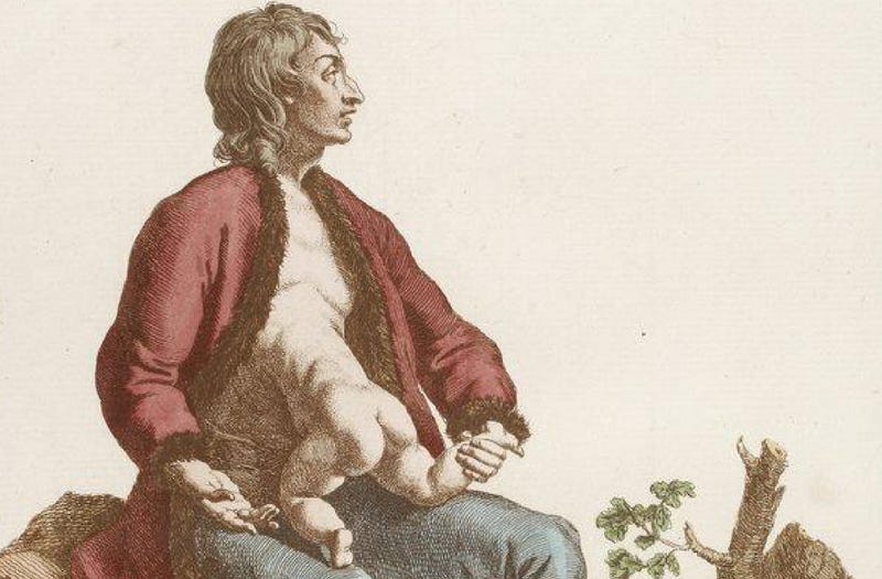 Illustration for article titled Beautiful Portraits of "Monstrosities" from the 18th Century