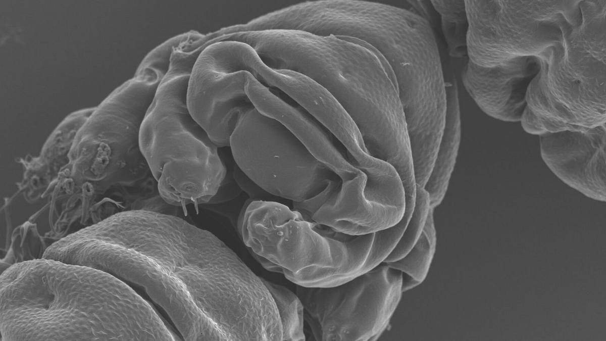 Scientists Finally Figured Out Why Tardigrades Are So