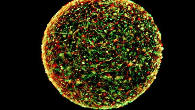 photo of New ‘Mini-Brains’ Could Put Thousands of Lab Animals Out of Work image